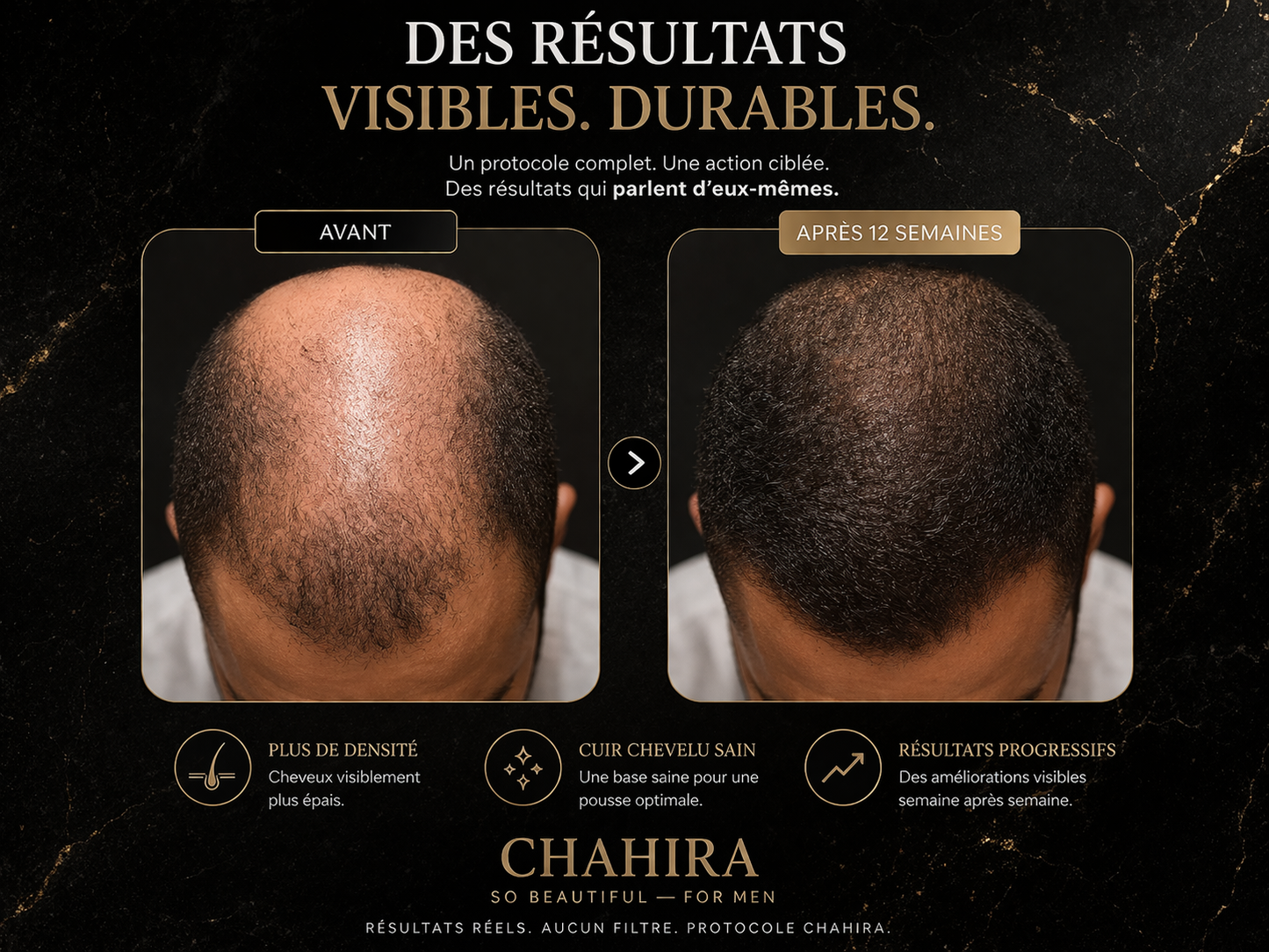 Coffret Activateur de Repousse Cheveux & Barbe – Chahira So Beautiful for Men