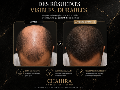 Coffret soin repousse capillaire homme Chahira – packaging élégant