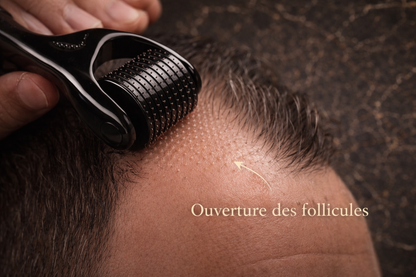 Dermaroller Cuir Chevelu : Stimulation Capillaire