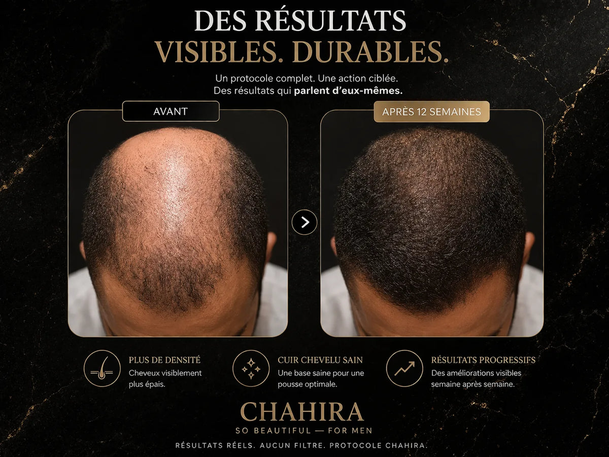 Coffret Activateur de Repousse Cheveux & Barbe : Chahira for Men